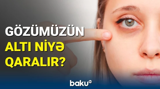 Göz ətrafındakı qaralmalar hansı xəstəliklərin əlamətidir?