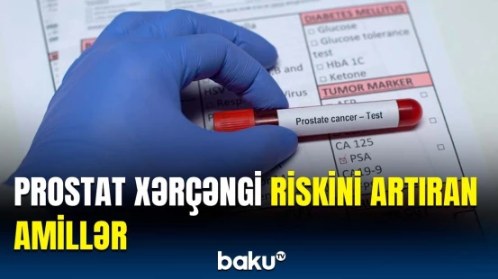 500 minə yaxın könüllü iştirak etdi və üzə çıxdı ki... | Alimlərdən maraqlı araşdırma