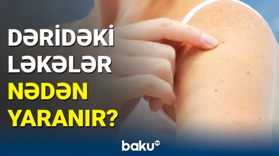 Bədəninizdə bu hallar baş versə... | Şəkər xəstəliyinin ilkin əlaməti açıqlandı