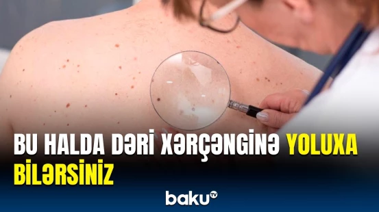 Melanomanın inkişaf riskini yaradan amillər | Həkimdən mühüm açıqlama