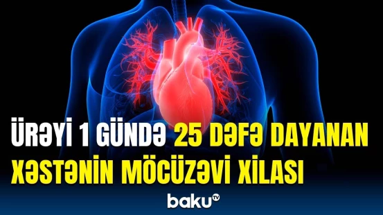 Həkimlərdən bir ilk | Ürəyi dəfələrlə dayanan xəstə necə sağaldı?