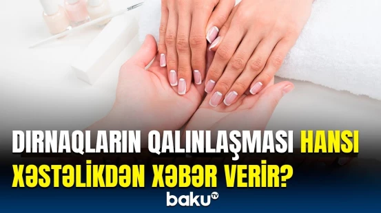 Gizli simptomların ölümə sürükləyən nəticəsi | Diqqətdən kənar qalan nüanslar