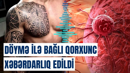 Döymə mürəkkəbi insan sağlamlığına necə təsir edir? | Risklər açıqlandı