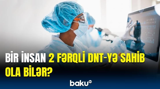 Daş adam sindromunun əlamətləri | Oğlan uşağı olan valideynlərə xəbərdarlıq