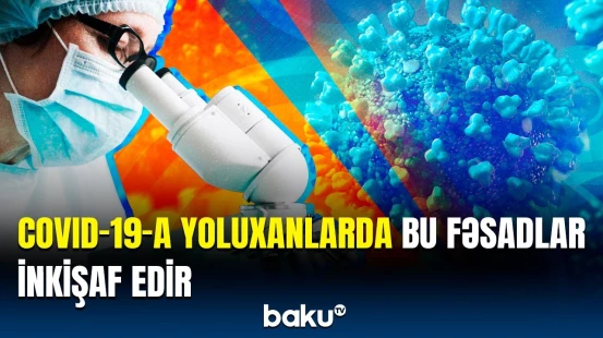 Alimlərdən COVİD-19-la bağlı yeni araşdırma