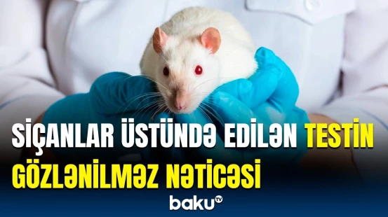 İnsan beyni barədə vacib araşdırma | Alimlər nəyi ortaya çıxardı?