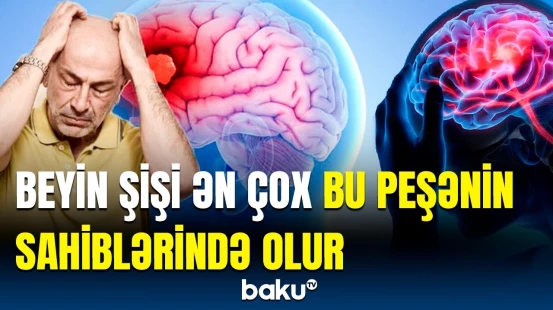 Beyin şişi necə əmələ gəlir? | Sınaq keçirildi və üzə çıxdı ki…