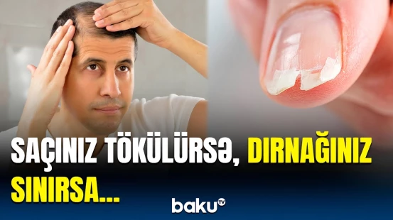 Bədəndəki bu əlamətlər nədən olur? - Yorğunluq hiss edirsinizsə...