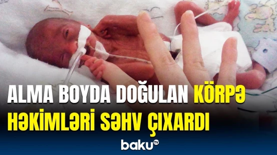 Həkimlər “sağ qalmayacaq” dedilər, amma... | Alma çəkisində olan körpənin möcüzəvi mübarizəsi