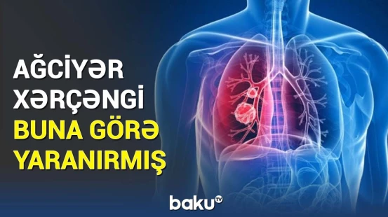 Bu qidalar insanı ölümə sürükləyir | Mütəxəssislərdən mühüm xəbərdarlıq