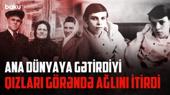 2 baş, 2 qol, 3 ayaq ilə doğulan siam əkizlərinin faciəsi | ARAŞDIRMA