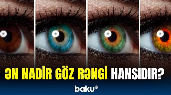 Dünyadakı insanların yalnız 2 faizi bu göz rənginə sahibdir | Fransalı cərrahdan maraqlı araşdırma