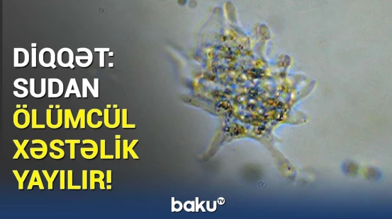 Həkimlər bu simptomları izah edə bilmir | Müalicəsi olmayan ağır xəstəlik yayılır