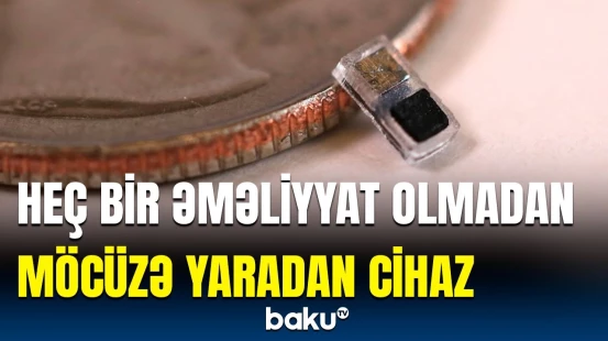 Tibb dünyasına səs salan cihaz | Düyüdən də kiçikdir, amma...