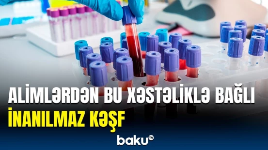 Altsheymeri əvvəlcədən öyrənmək mümkün olacaq? | Ən sadə və ucuz üsul