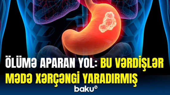 Bu qidalardan və vərdişlərdən uzaq durun, yoxsa… | Onkoloqdan təcili açıqlama