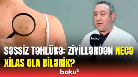 İnsan bədənində ziyillər hansı təhlükələrə yol açır? | Həkimlər açıqladı