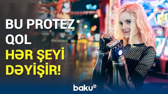 Qolunu itirən 19 yaşlı qızın texnologiya ilə bərpa olunmuş həyatı