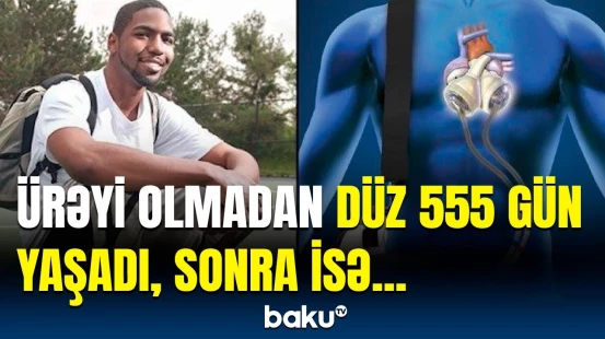 Tibbi möcüzə | Ürəyini çantasında gəzdirən oğlanın ağlasığmaz hekayəsi