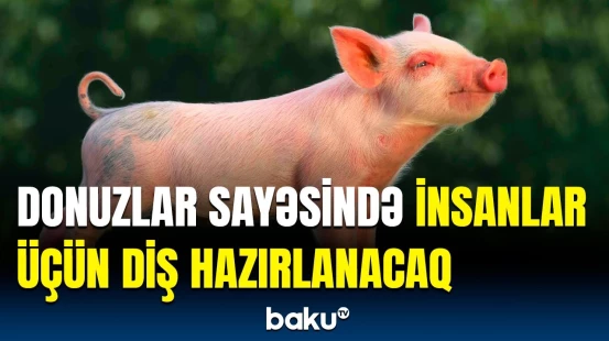 İtirilmiş dişlərin bərpasındakı bu üsul dünyaya səs saldı