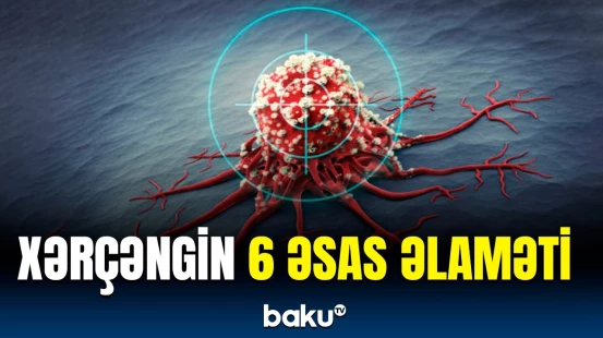 Bu simptomlar varsa, mütləq həkimə gedin, yoxsa… | Həkimlərdən təcili xəbərdarlıq