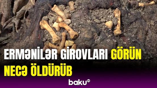 Ermənilərin Xocalıda törətdiyi dəhşətli əməl | Geyimlərdən aşkar görünür ki...