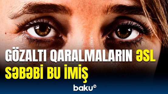 Gözaltı qararmalar hansı xəstəliklərin xəbərçisidir? - Bu, sağlamlıq üçün həyəcan siqnalıdır!