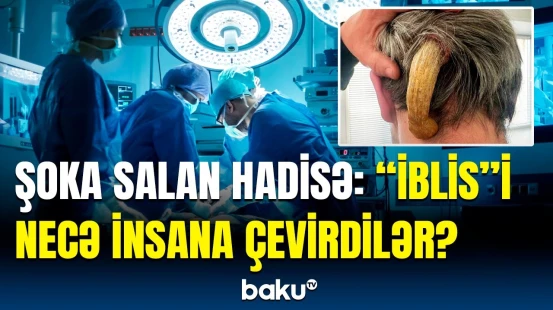 Rusiyalı həkimlər bu əməliyyatla hər kəsi heyrətləndirdi