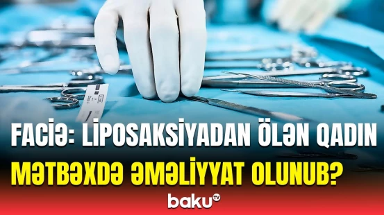 Nazir liposaksiyadan ölən qadından elə şeylər danışdı ki... | Dəhşətli açıqlamalar