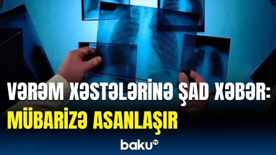Xəstəlikdən sağalmaq bu yolla daha da asanlaşacaq | İlk dəfə sınanan metodun nəticələri