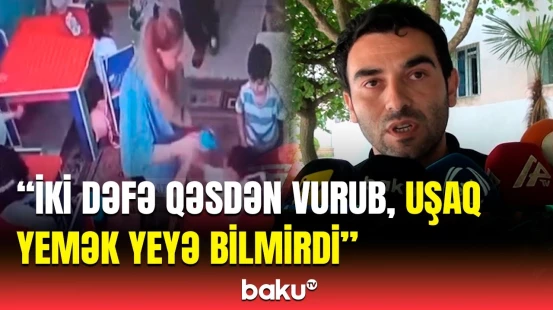 Müəllim etiraf etdi ki, mən vurmuşam uşağı... | Bağçada döyülən uşağın atası hər şeyi danışdı