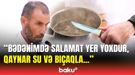 “Bir ayağı tamam yox idi...” | Əsir və girov götürülmüş şəxslər yaşadıqları dəhşəti danışdı