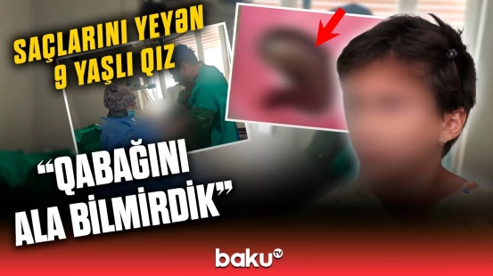 “Ürəyim tez-tez bulanırdı” | Saçlarını yeyən 9 yaşlı Lalə və anası danışdı