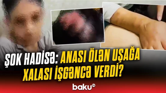 İnsanlığa sığmayan hərəkət | 14 yaşlı yeniyetmənin görüntüləri gündəmi silkələdi