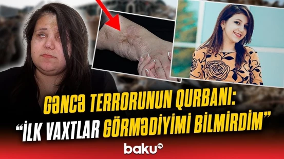 “Qoymayın ölüm, qızlarım var” | Gəncə terrorunda gözlərini itirən qadın başına gələnləri danışdı