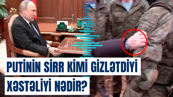 73 yaşlı Putinin əllərində şiş və göyərmə | Rusiya liderinin yeni görüntüləri gündəm oldu