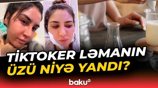 Sosial şəbəkələrdə kosmetik məhsulların reklamı düzgündür? - Baku TV