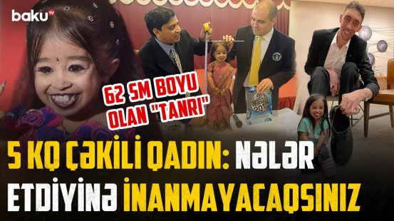 Sümükləri birləşmir, ayaq pəncələri 8 sm-dir | "Dünyanın ən kiçik qadını" görün necə yaşayır