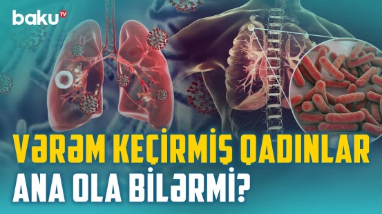 “Bu halda vərəmin sonu ölümdür” | Xəstələrlə təmasda olanlar da vərəmə yoluxa bilər? - BAKU MED
