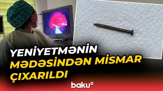 Bakıda pasiyentin mədəsində yad cisim aşkarlandı - Baku TV