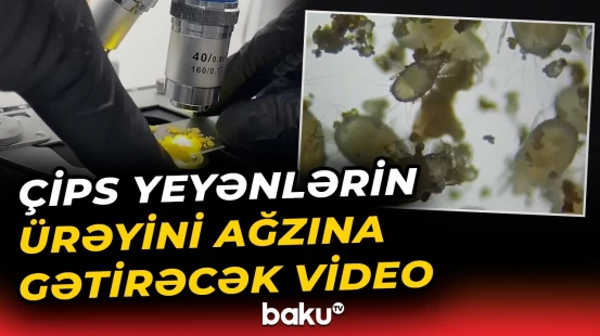 “İçindən həm həşəratlar çıxdı, həm də..." | Çips paketlərinin içində qurdlar olur? - Baku TV