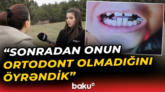 Müalicə üçün həkimə aparıldı, ağzını bağlaya bilmir - Baku TV
