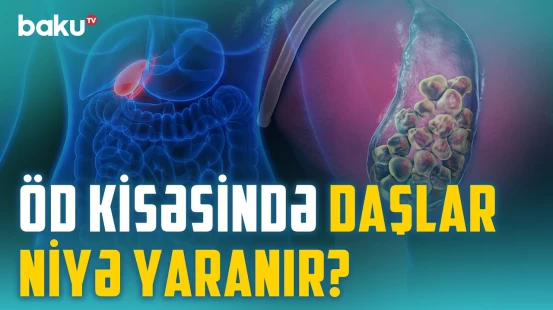 Öd və qaraciyər xəstəlikləri: əməliyyat hansı halda şərtdir? - Xərçəng riski yaradan amil | BAKU MED