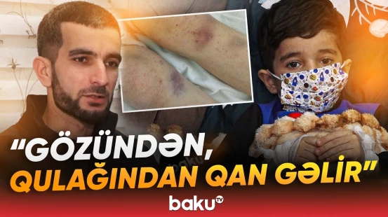 ”Aciz ata kimi xahiş edirəm” | Ağır xəstəlikdən əziyyət çəkən Pünhanın atası imdad dilədi - Baku TV