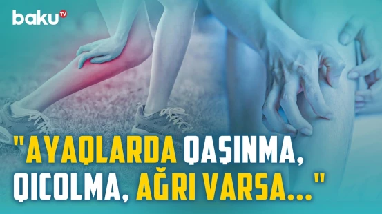 Varikoz müalicə olunmasa, nə baş verə bilər? - Damar genişlənməsinin bilinməyən səbəbi