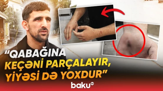 “Maşından düşən kimi hücum etdi” | Mərdəkan sakinləri təşviş içində - Baku TV
