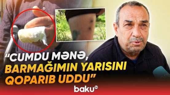"Gəlib gördülər ki, al qanın içindəyəm" | Çaqqal kəndə hücum etdi: Yaralılar var - Baku TV