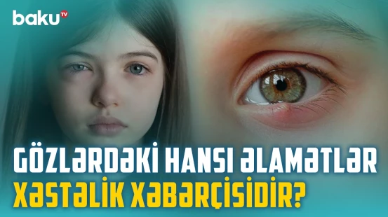 Gözlərin zəifləməsinin başlıca səbəbləri | Görmə qabiliyyətini itirməmək üçün nə etməli? - BAKU MED