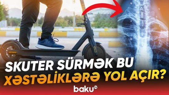Skuter uşaqlarda ciddi sağlamlıq problemlərinə səbəb olur | Həkimlər xəbərdarlıq edir - Baku TV