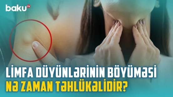 Xoşxassəli və bədxassəli limfa düyünlərinin əsas fərqləri nələrdir? - BAKU MED